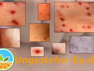 Aussehen juckende Pusteln, Stiche, Pickel, Mückenstiche?